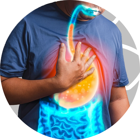 Imagem-interna-cirurgia-para-refluxo-gastroesofágico-Carla-Moises